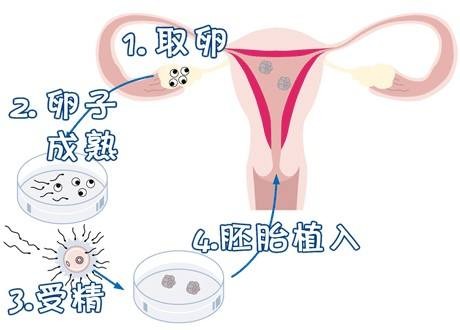 借卵代孕哪里做的最好